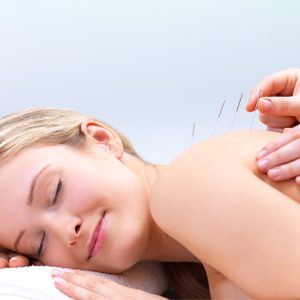 Chiropractic Parkville MD Dry Needling